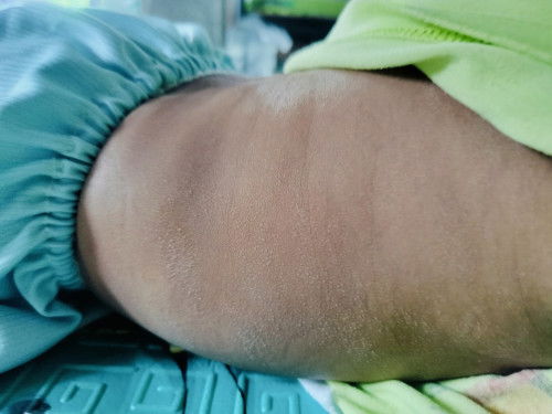 ผิวลูกแห้งลอก ทาครีมตัวนี้ได้มั้ย