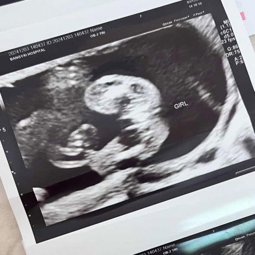 นับลูกดิ้นกี่วีคคะแม่ๆ