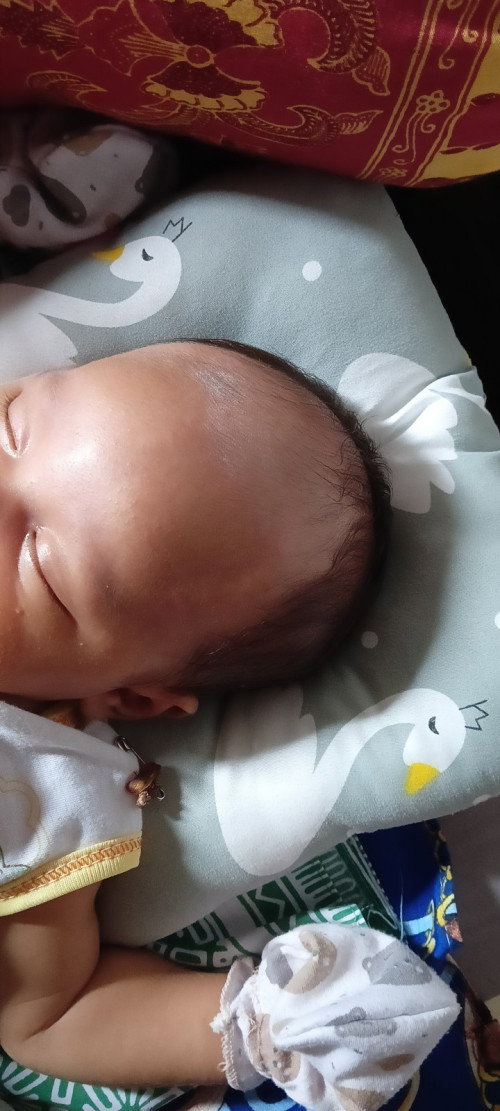 Perawatan anak