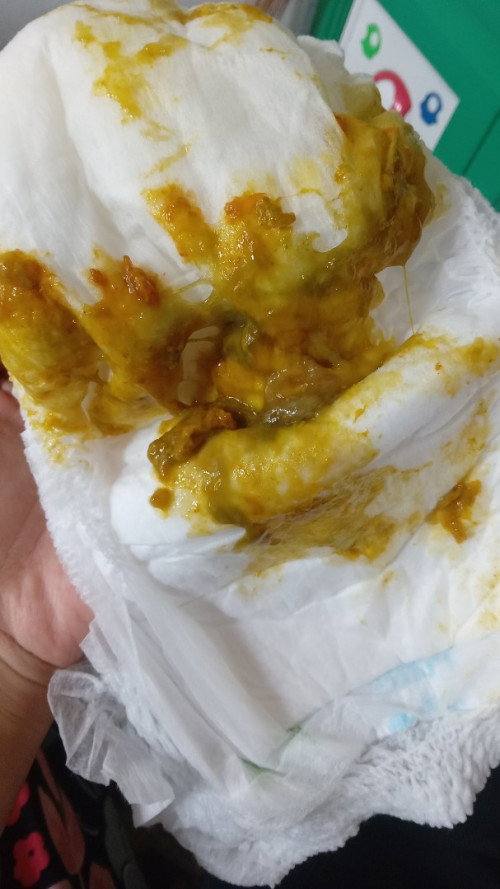 Bab usia 8 bulan 1 hari berlendir