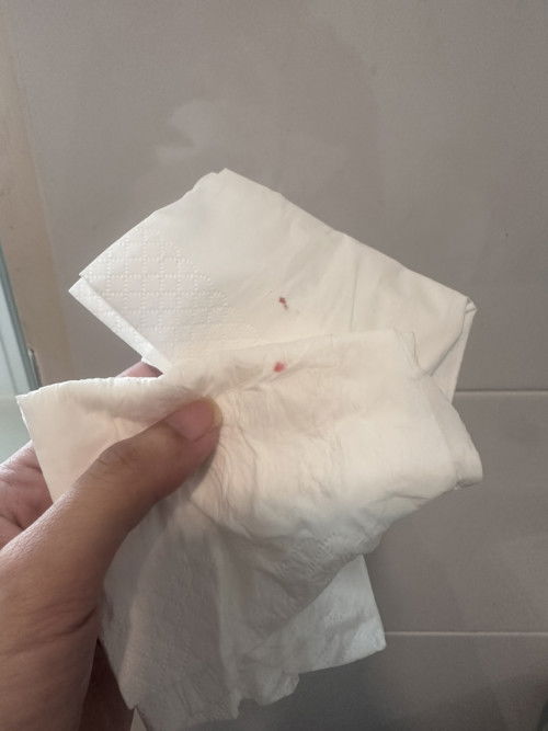 มีคุณแม่ท่านไหนมีประสบการณ์เลือดออกเป็นจุดๆ แบบนี้บ้างไหมคะ