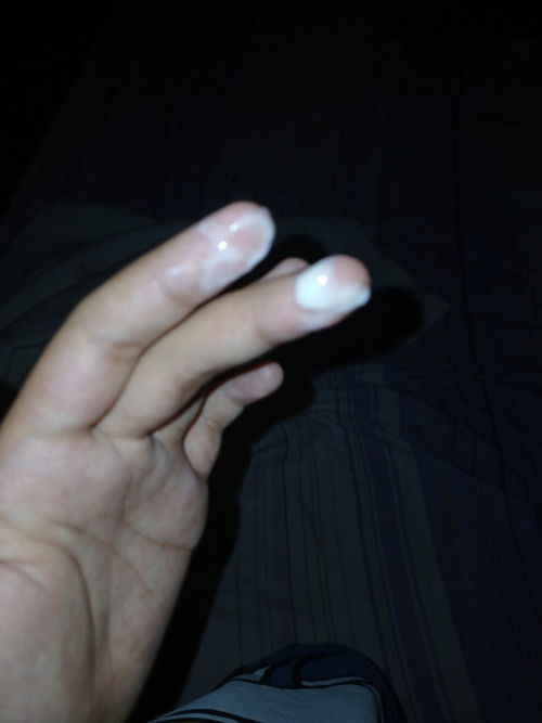 nak tanye kalau keputihan macam ni normal ke ?