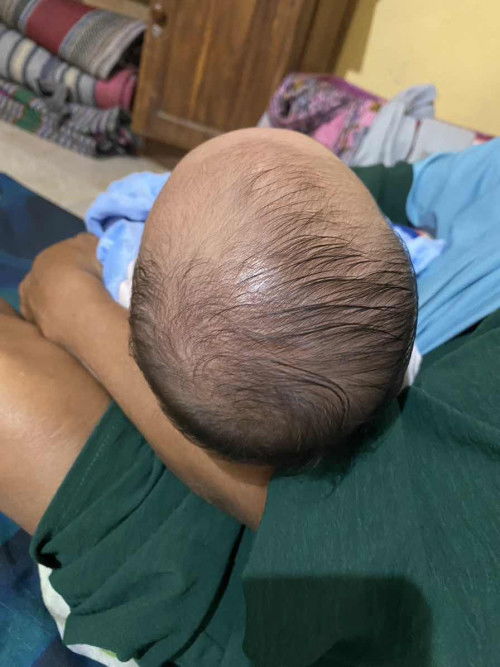 Kepala bayi peyang atau tidak