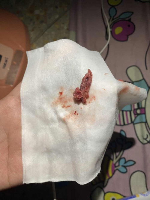 คืออะไร อันตรายมั้ย?!??