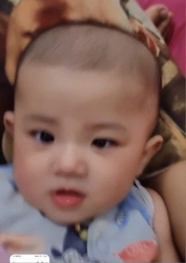 Mata anakku kecil sebelah