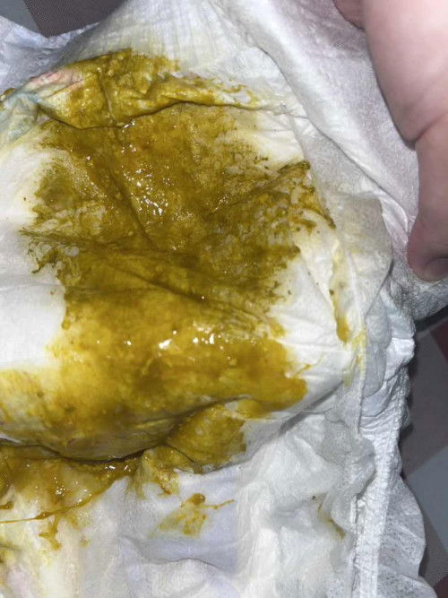 Baby cirit birit sebab susu tak sesuai ke ?