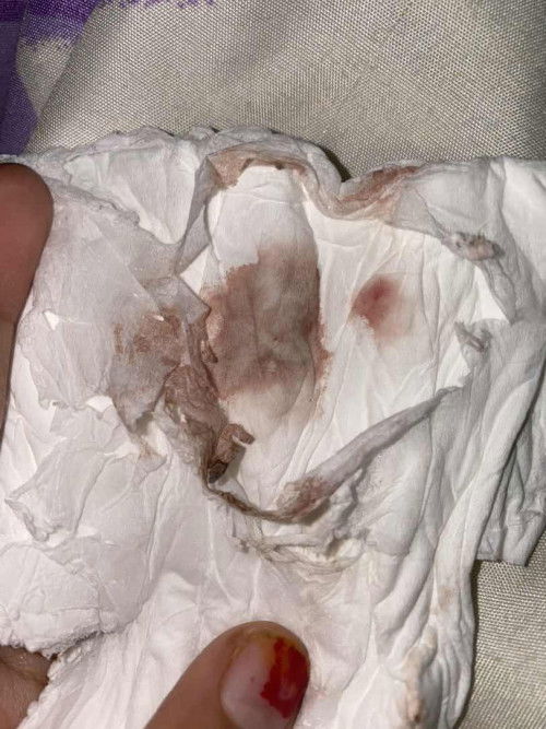 Keluar flek hamil 6 minggu