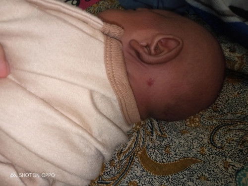 Merah merah dikepala gak ilang