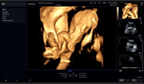 ท้อง3 ซาวด์4มิติ