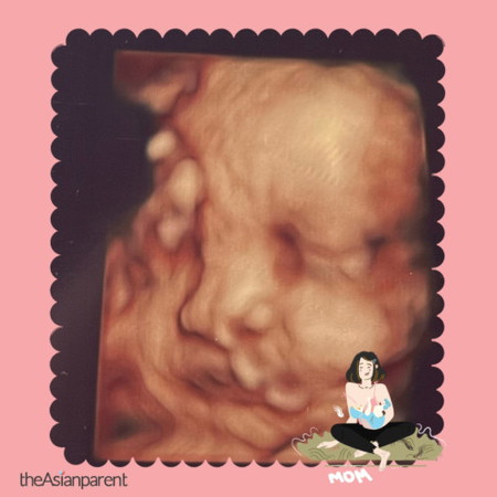 normal ke tali pusat ke tu😢