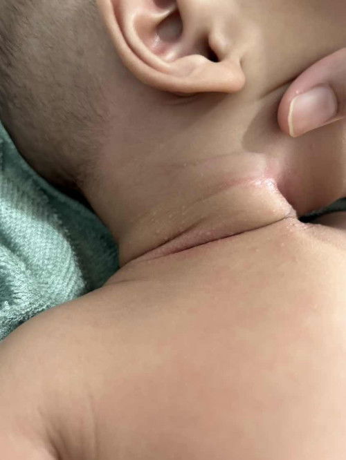 Bintik - bintik pada leher