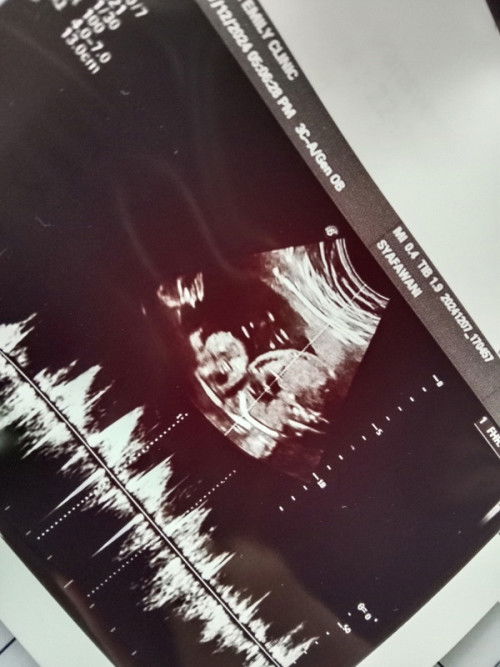 Gender yang tak pasti ?? Boy or girl ? Help me 🤣