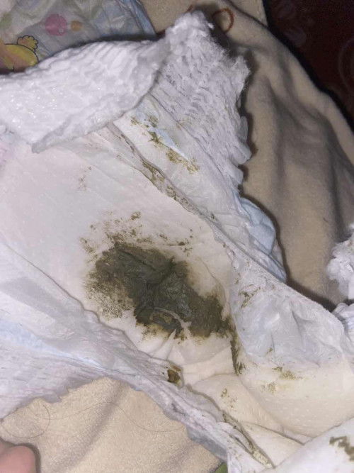 สีอึกแบบนี้ปกติไหมค่ะกินนมผงบางครั้งก็มีสีเหลืยงปน