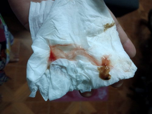 มีมูกเลือด ปากมดลูกไม่เปิด