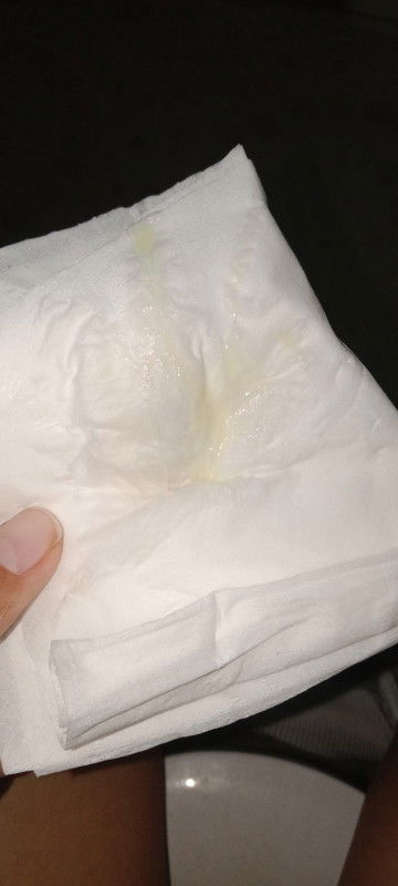 สอบถามอาการ