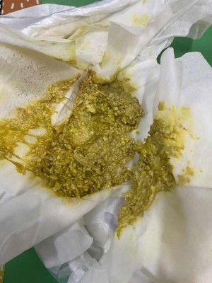 Bun tolong bantuannya yg pernah ngalamin