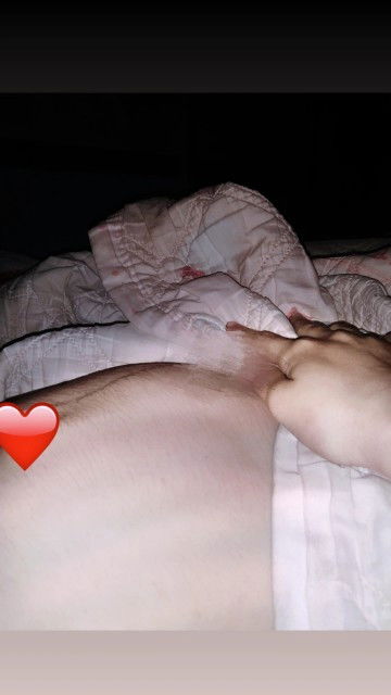 สอบถามเเม่ๆคนอื่นหน่อยคะ พานั่งนานๆหรือนอนหงายบางทีก็เป็นเอง ท้องจะนูนเเข็งพอซักพักก็หาย