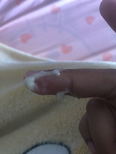 37+6ท้องแรกไม่รู้ตกขาวรึมูกค่ะ