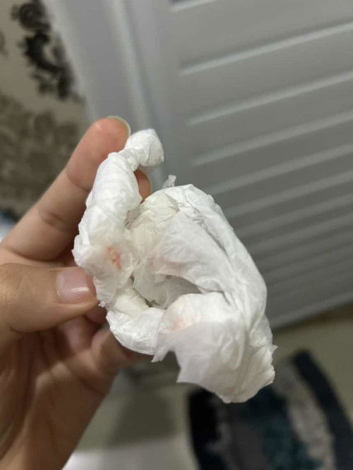 Darah di ingus bayi saat di sedot menggunakan nasal aspirator