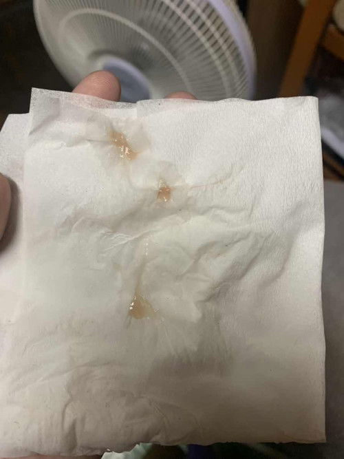 มีมูกแต่ยังไม่ปวดท้องหรือท้องแข็ง