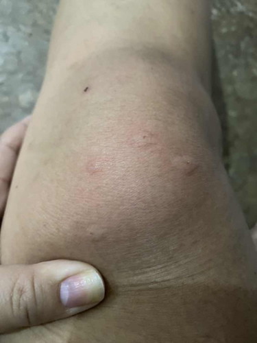 แมวข่วน ท้อง5เดือน