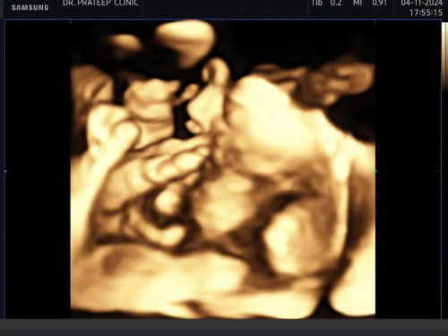 คลอดโรงบาล สมเด็จ ศรีราชา