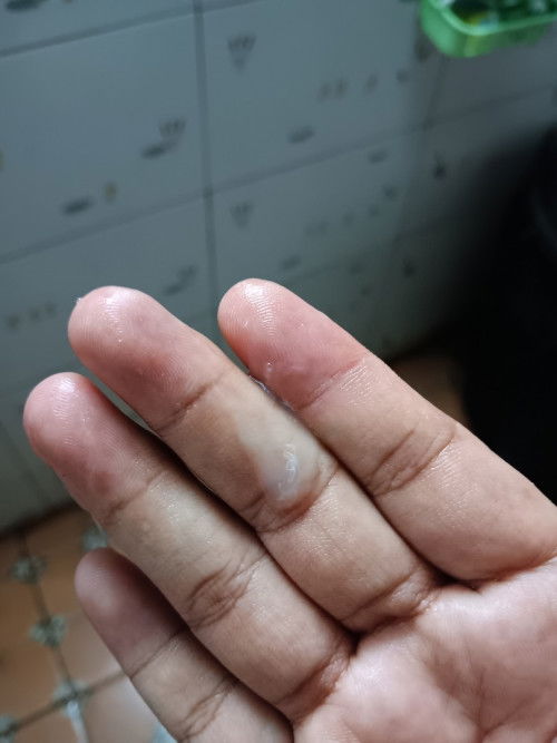 ใช่มูกใกล้คลอดไหม