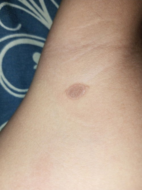 Ada yang tau ini apa dan obatnya?