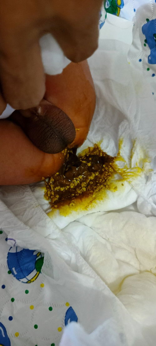 New Born Formula Milk, Normal po ba yung ganitong tae ni baby?