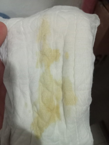39 weeks discharge