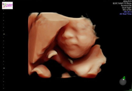 Betis dan pinggang pegal2