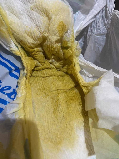 Feses bayi 1 bulan cair