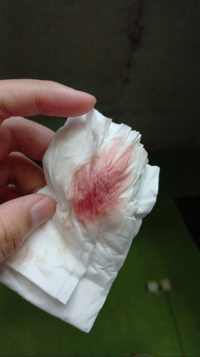 Hamil 8 week tpi keluar flek sdh 3 >minggu kemarin USG ktanya janin sehat dan ada detak jantungnya