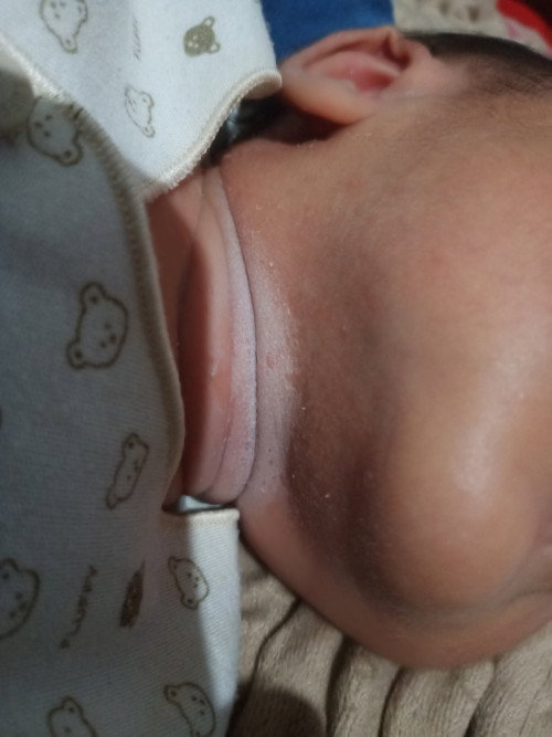 Leher bayi putih dan berbau