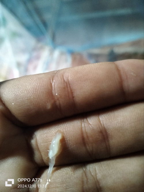 Minggu ke 38 ,3 hari