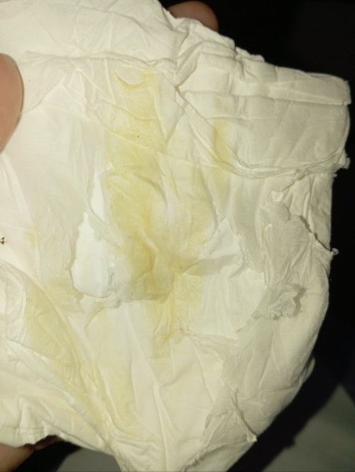 Keputihan setelah persalinan