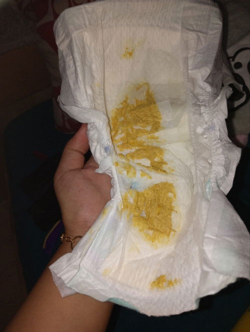 Pup bayi warna kuning pucat