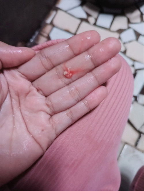 tanda kehamilan/ keguguran