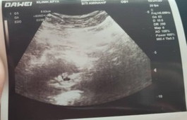 4 minggu baby sulung