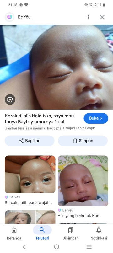 Bun mau tanya cream buat ngilangin kerak alis bayi  1 bln