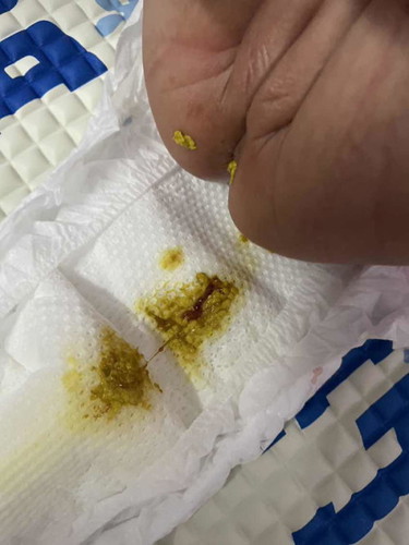 Najis baby ada warna merah