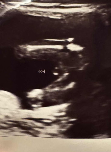 Boy or Girl