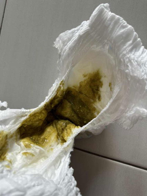 Warna najis baby 5 bulan