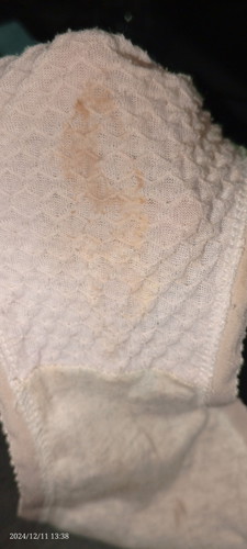 Brown Discharge