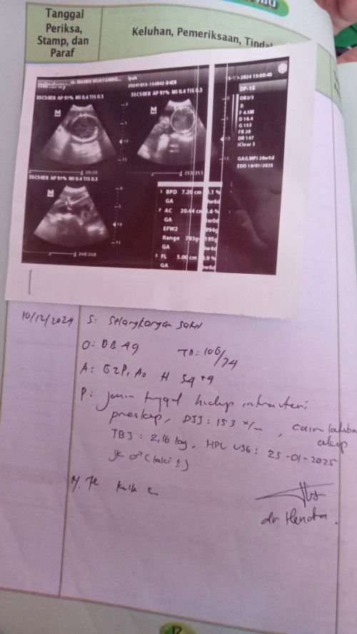 Usia kehamilan 34minggu 4 Hari Bb Janin 2,16 Kata nya masih kurang emang normal nya berapa bun?