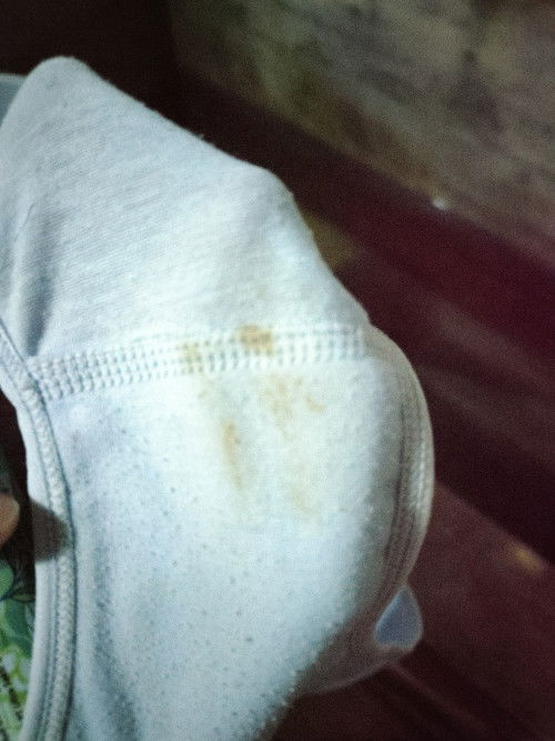 Flek coklat usia kandungan 7 minggu