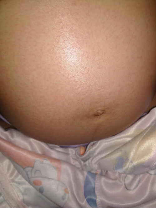 แม่ๆบ้านไหนเป็นเหมือนกันไหมคะ