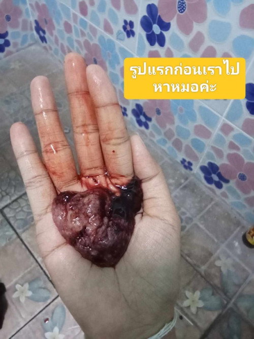 รบกวนปรึกษาแม่ๆหน่อยค่ะ