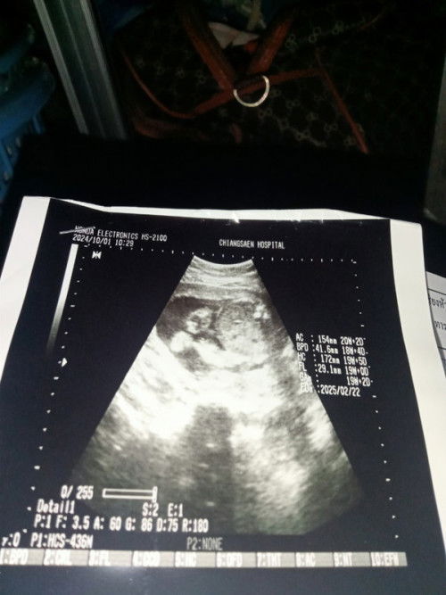 เพศอะไรคะ