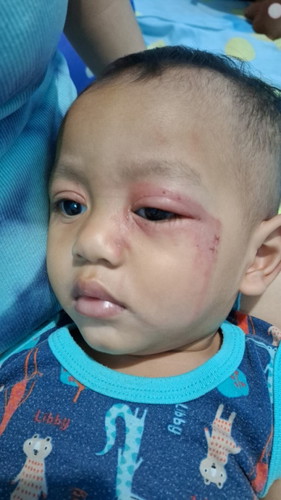 Mom ada yg pernah gini ga anaknya? Bingung banget 2 kali berobat malah makin parah